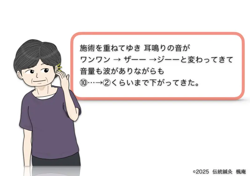突発性難聴