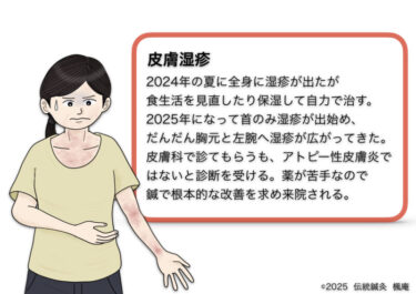 皮膚湿疹
