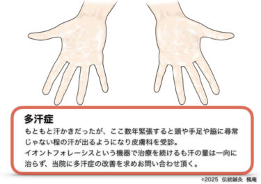 多汗症