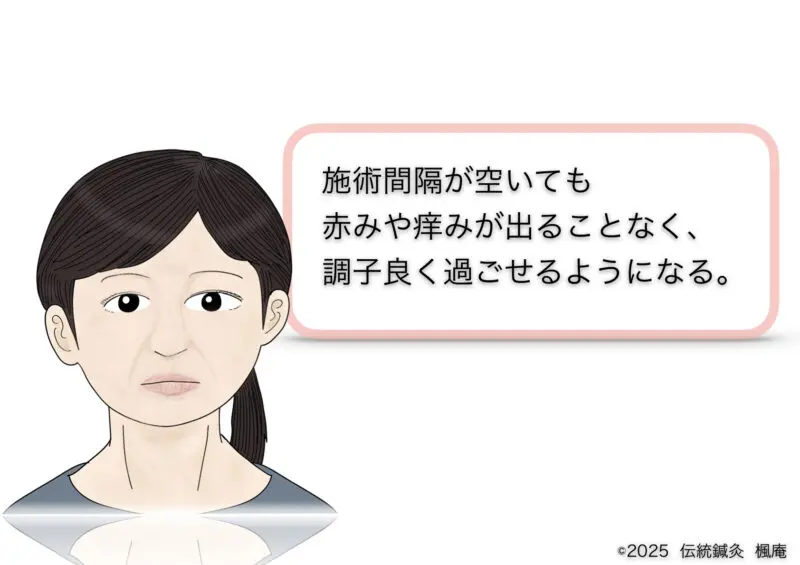 酒さ・接触性皮膚炎