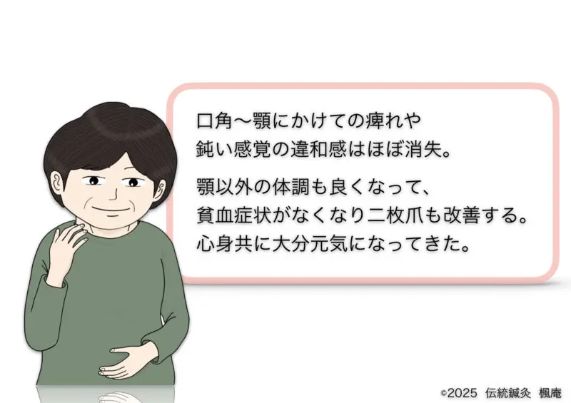 下歯槽神経麻痺(オトガイ神経麻痺)