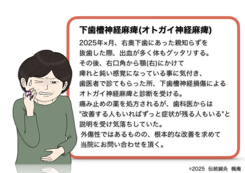 下歯槽神経麻痺(オトガイ神経麻痺)