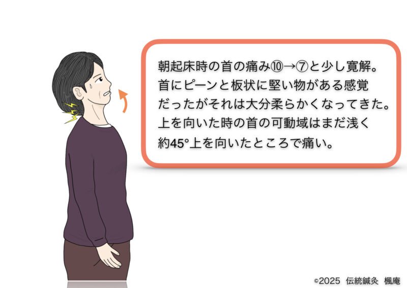 リウマチ性多発筋痛症