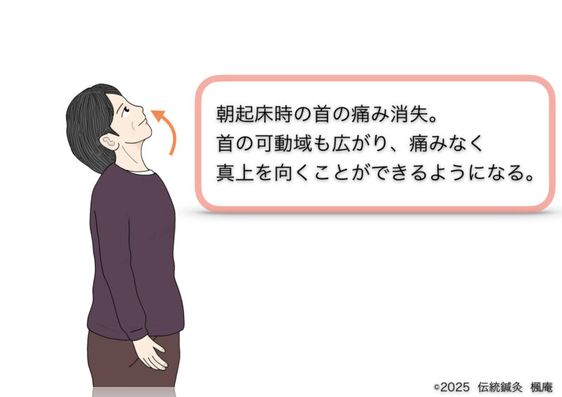 リウマチ性多発筋痛症