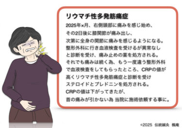 リウマチ性多発筋痛症