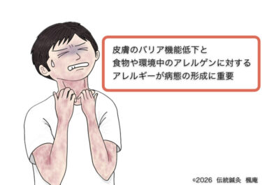 アトピー性皮膚炎