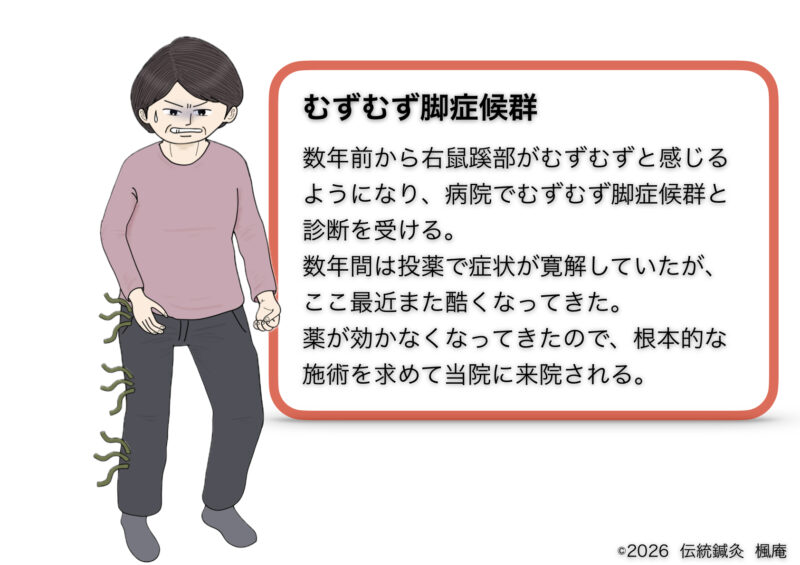 むずむず脚症候群