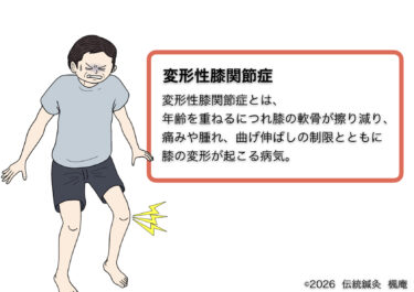 変形性膝関節症