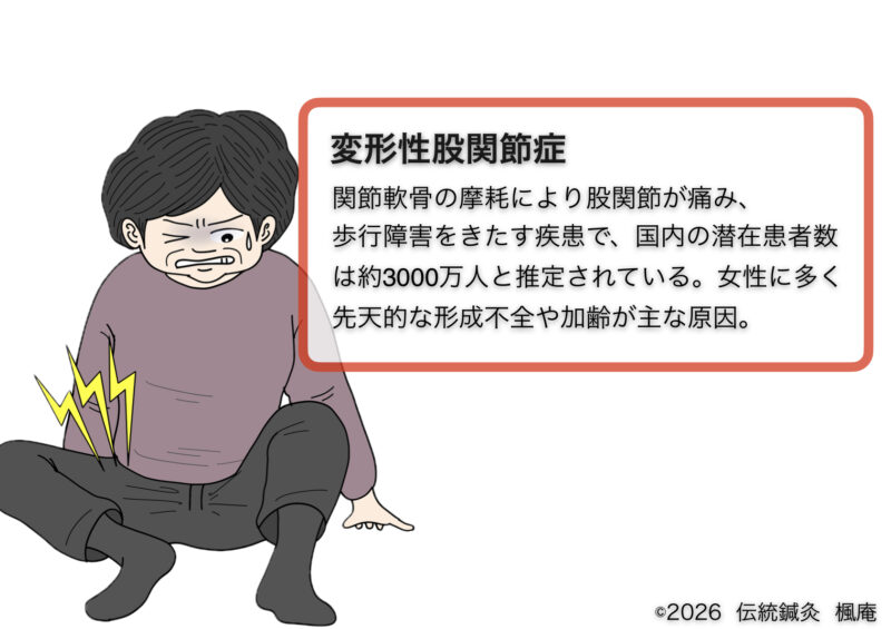 変形性股関節症