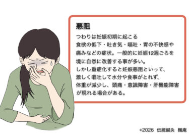 悪阻