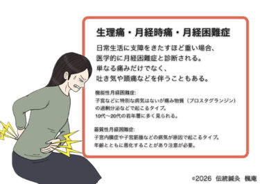 生理痛・月経時痛・月経困難症