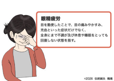 眼精疲労
