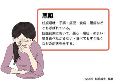 悪阻