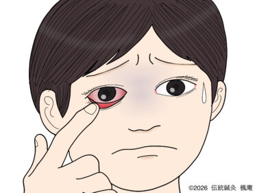 結膜炎