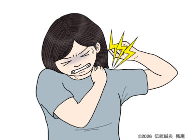 胸郭出口症候群