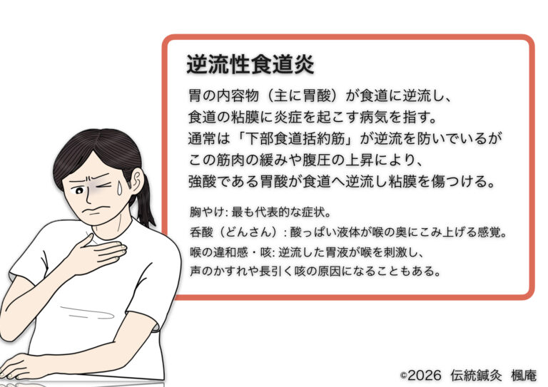 逆流性食道炎 | 伝統鍼灸楓庵｜大阪府吹田市の伝統鍼灸院