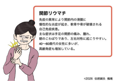 関節リウマチ