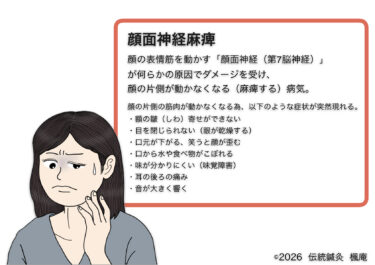 顔面神経麻痺