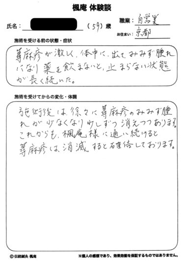 【体験談】慢性蕁麻疹：京都府京都市のM.Tさん